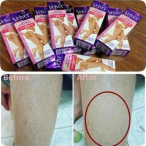Kem tẩy lông velvet tẩy sạch lông trong 5 phút an toàn [Cam kết hàng chuẩn Nga] | BigBuy360 - bigbuy360.vn
