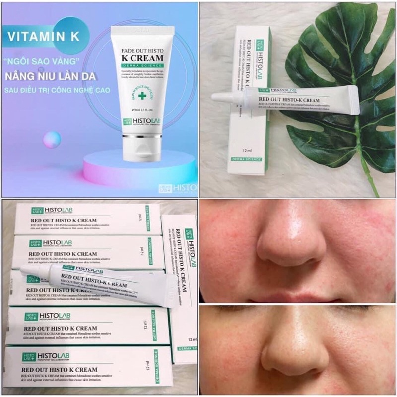 [HÀNG NHẬP KHẨU] Kem Dưỡng Tái Tạo Da Sau Liệu Trình Histolab Fade Out Histo K Cream Giảm Vết Đỏ Bầm Cải Thiện Đốm Nâu