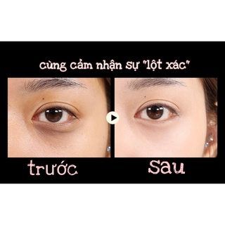 Mặt nạ mắt Images chứa tinh chất Hyaluronic acid/rong biển /ngọc trai đen 80g (60 cái)