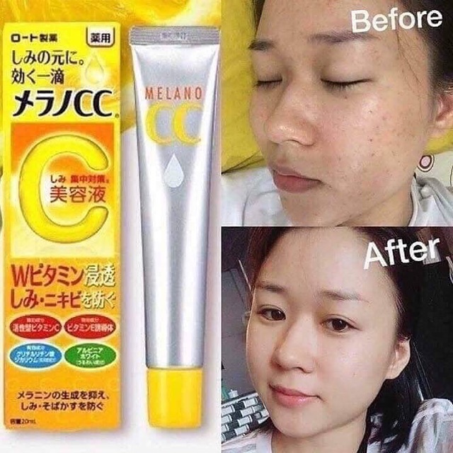 Serum vitamin C Melano CC Rohto