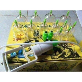 Bộ giác hơi không dùng lửa