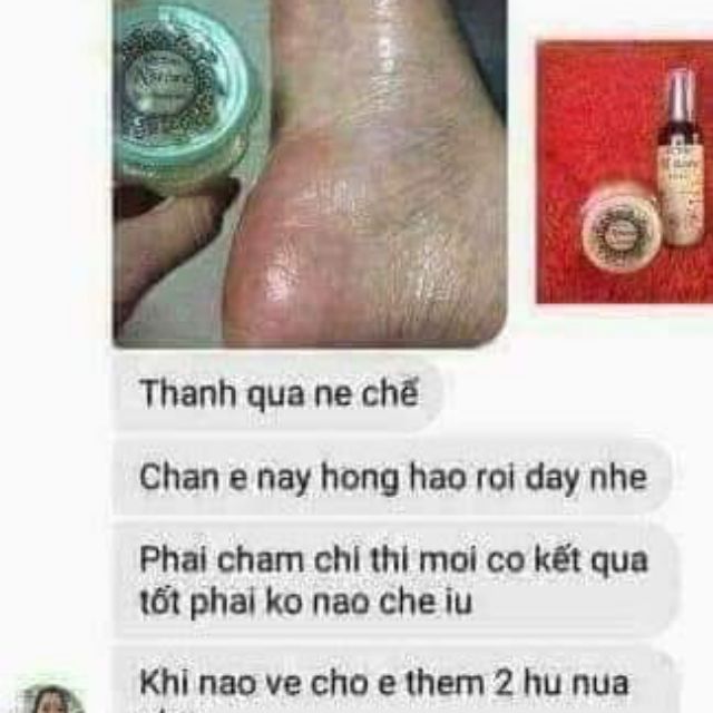 Mỡ trăn cao cấp trị nứt nẻ da và dưỡng da