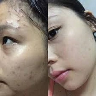 thuốt bắc tái tạo da 50ml