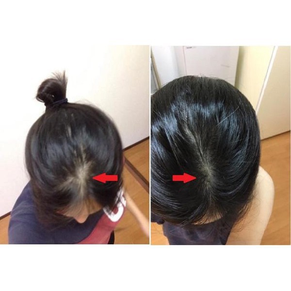 Tinh Chất Mọc Tóc, Cấp Ẩm Nuôi Dưỡng Tóc Radical Med  Chiết Xuất Cỏ Đuôi Ngựa 5ml | BigBuy360 - bigbuy360.vn