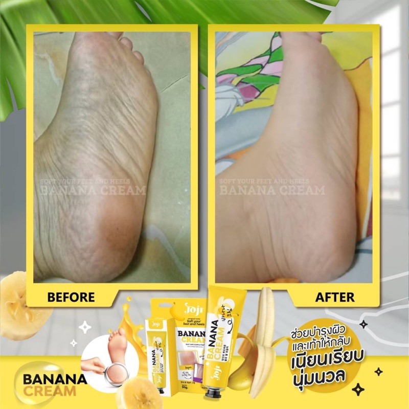 Kem Giảm Nứt Gót Bàn Chân Banana Cream Feet and Heels 50g