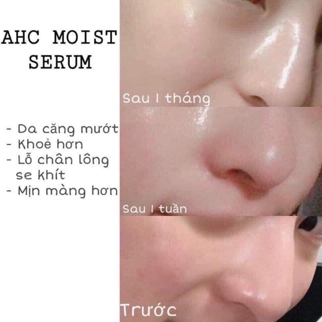 🎊Tinh chất Serum AHC Capture Solution Max Ampoule  #50ml💃