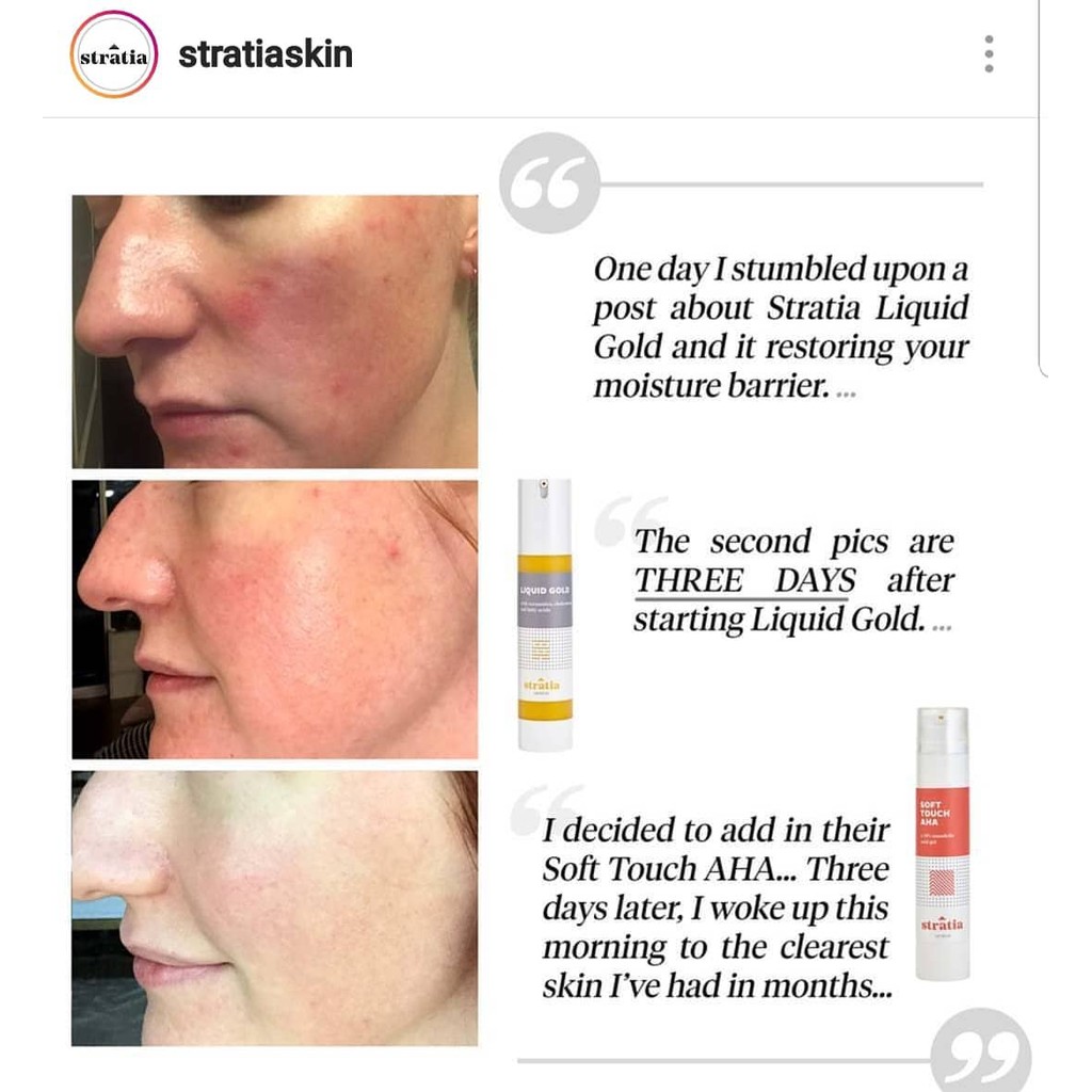 Serum 10% Mandelic Acid Stratia Soft Touch AHA 40 ml tẩy da chết dịu nhẹ