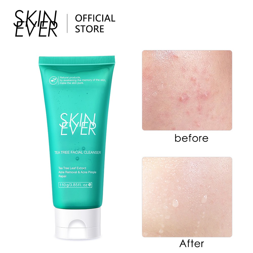 Sữa Rửa Mặt SKIN EVER Dưỡng Ẩm / Làm Trắng Da / Hỗ Trợ Giảm Mụn Cao Cấp Tiện Dụng 110g