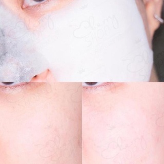 Mặt nạ sủi bọt thải độc SUM: 37 Bubble-De Mask Award Bubble