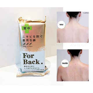 XÀ PHÒNG MỤN LƯNG FOR BACK