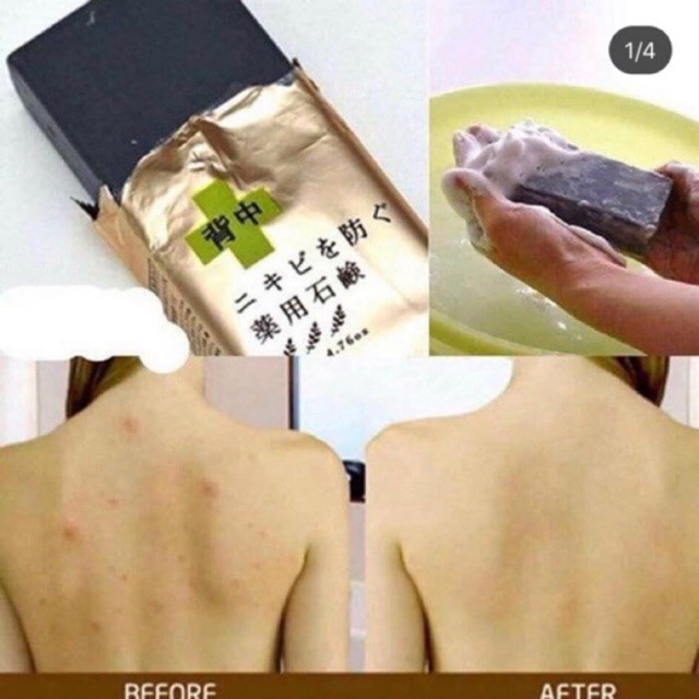Xà Phòng Pelican For Back Medicated 135g Hỗ Trợ Cải Thiện Mụn Lưng của Nhật Bản