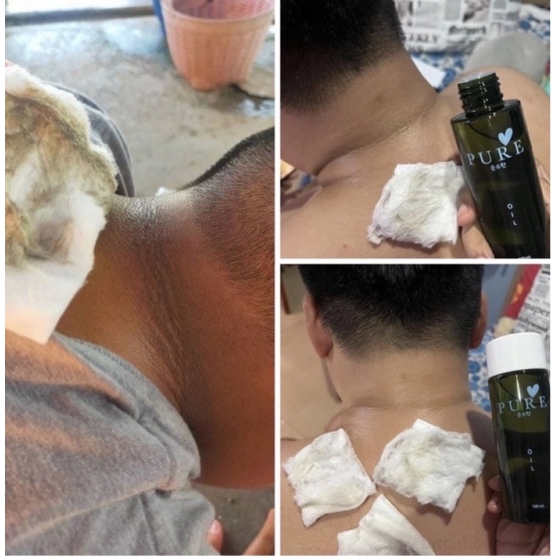 Dầu rạn da cho bà bầu Thiên Nhiên Thái Lan - Ngăn ngừa và làm giảm rạn da khi mang thai 100ml