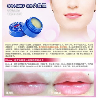 Son Dưỡng Môi Blistex Lip Medex