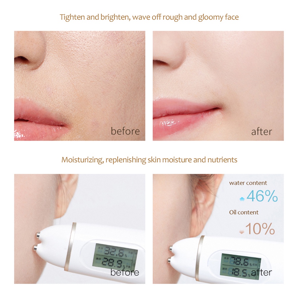 Mặt huyết thanh Collagen instalift protein Chủ Đề Nâng Bộ Mặt Filler hấp thụ collagen protein Chủ Đề Làm săn chắc chống lão hóa mặt huyết thanh okase