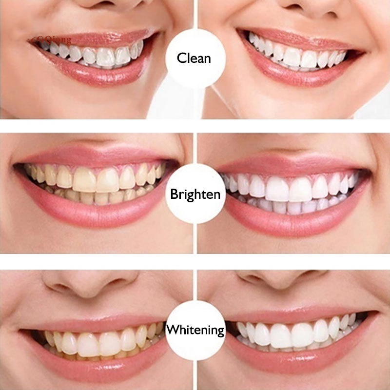 Bút Gel làm trắng răng Kem đánh răng loại bỏ vết bẩn chất lượng cao loại bỏ vết bẩn hàm răng trắng khỏe