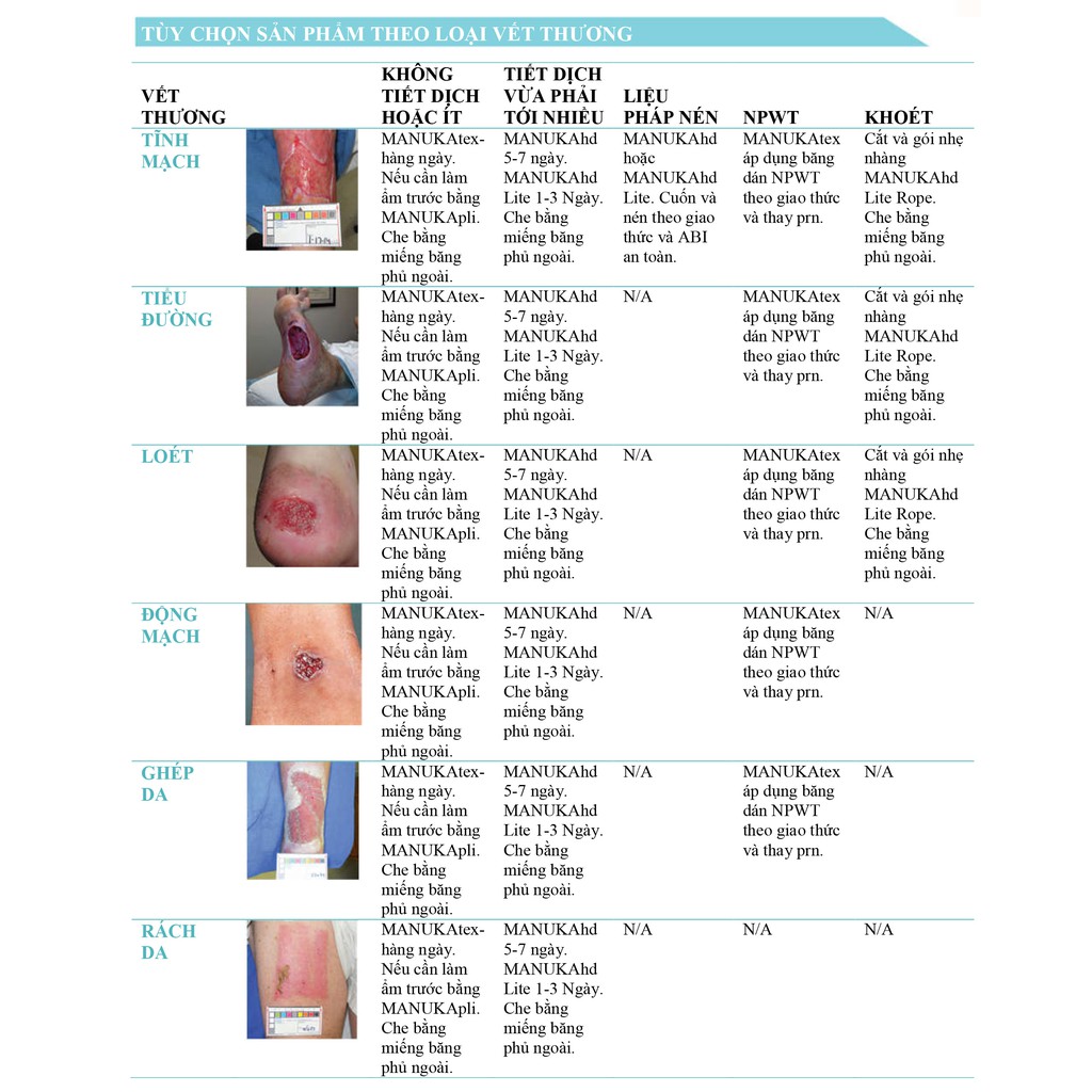 BĂNG VẾT THƯƠNG KHÁNG KHUẨN DẠNG FOAM MEPILEX AG