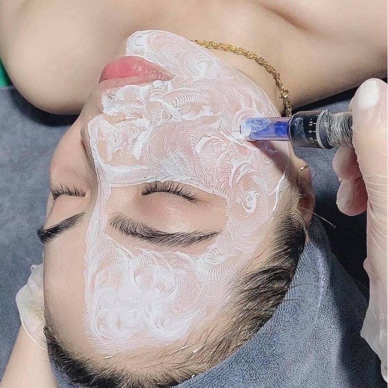 CẤY TRẮNG - dưỡng da , trẻ hoá da, bật tone 3-5 tone