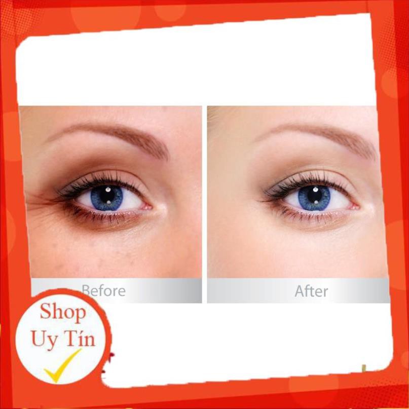 [FreeShip đơn từ 50K] Kem Klirvin ĐẶC TRỊ QUẦNG THÂM MẮT , xóa tan bong mắt trong 1 tháng [chính hãng Nga] G039 | BigBuy360 - bigbuy360.vn