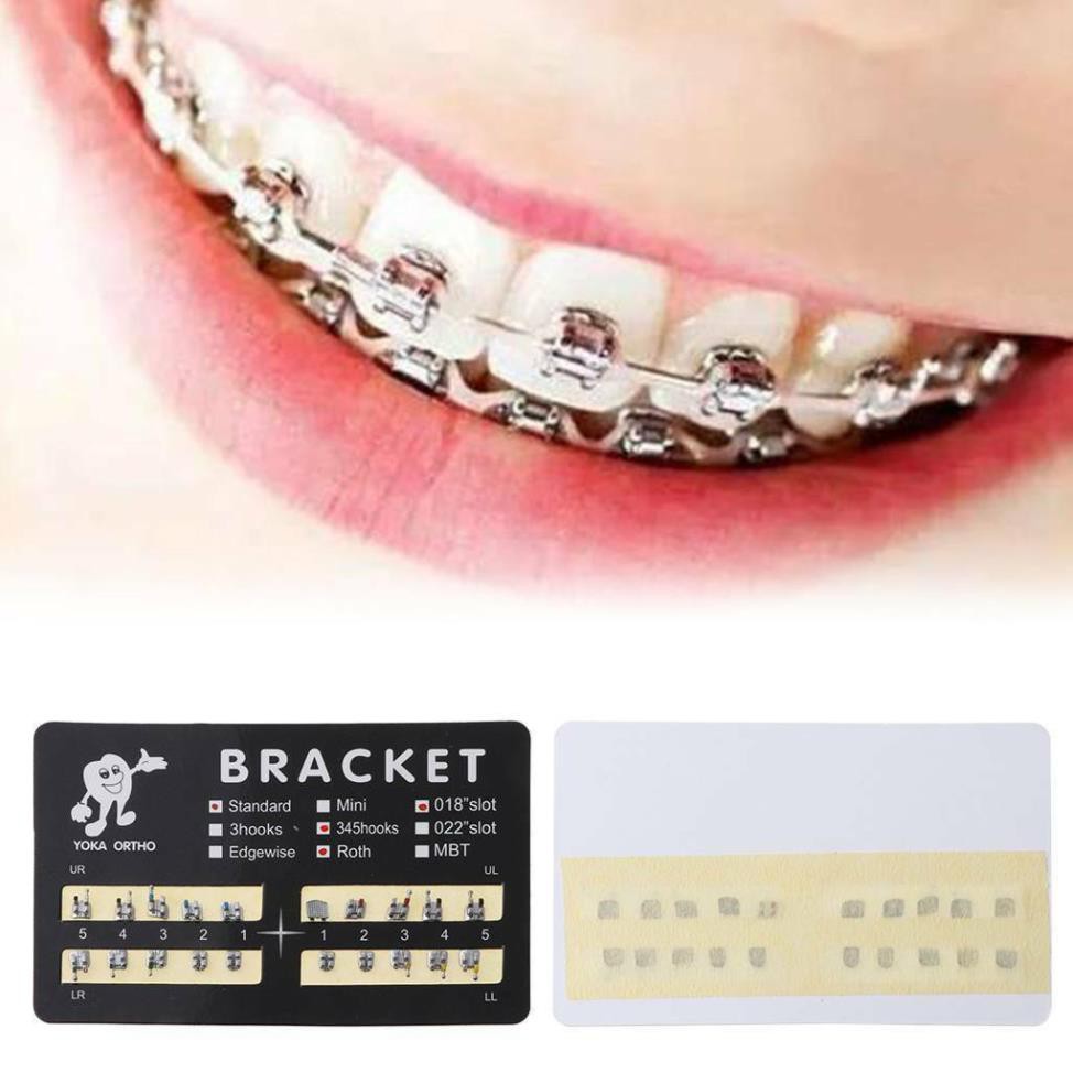 Mắc cài kim loại chỉnh nha, mắc cài bao giấy