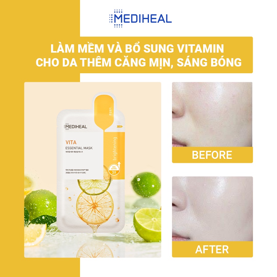 Mặt Nạ Dưỡng Da Trắng Sáng, Mờ Thâm Cho Da Mụn Mediheal Vita Brightening Essential Mask 24ml