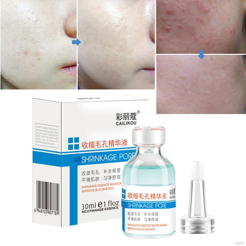 [Hàng mới về] Serum loại bỏ mụn đầu đen thu nhỏ lỗ chân lông dưỡng ẩm da