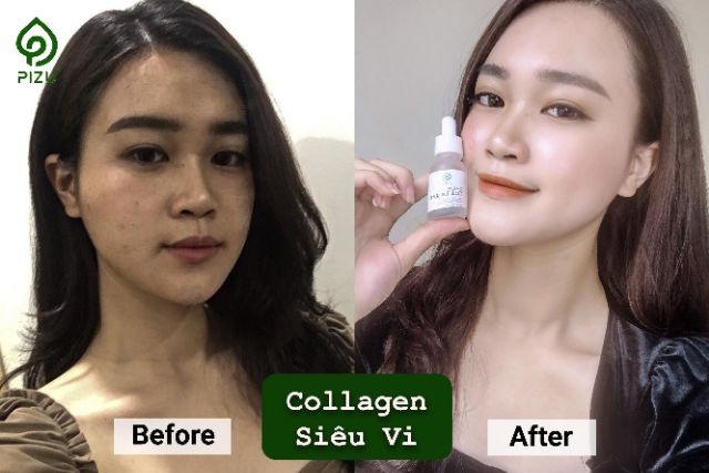 COLLAGEN SIÊU VI