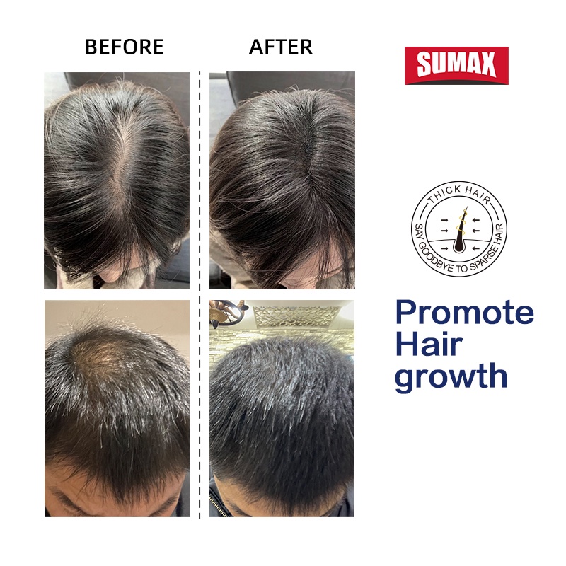 Dầu gội SUMAX chống rụng tóc chiết xuất gừng thích hợp đi du lịch 50ml