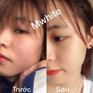 Serum 7 day Mwhite