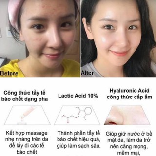 [The Ordinary] Serum sáng da giảm thâm Lactic Acid 5% + HA