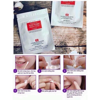 Miếng dán mụn Cosrx Acne Pimple Master Patch 24 miếng
