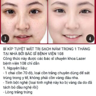 Tinh bột nghệ vàng nguyên chất