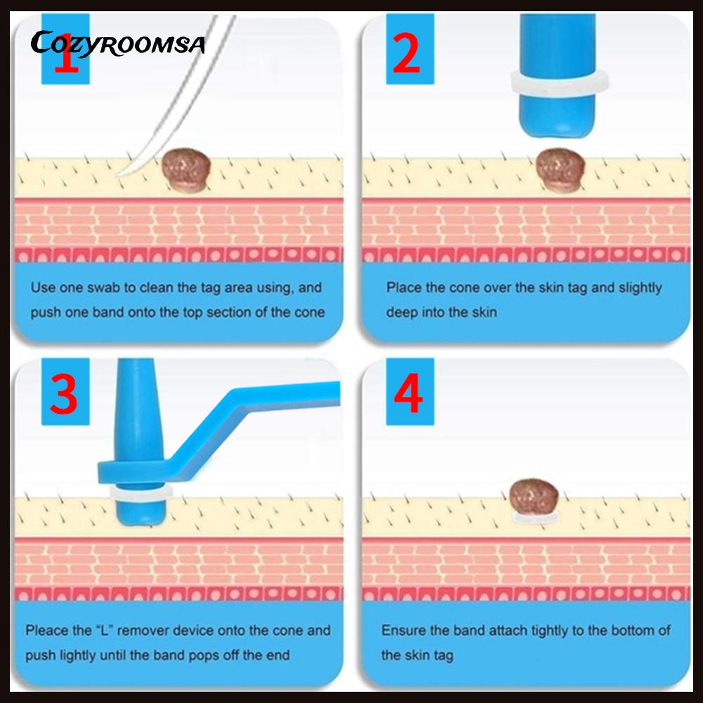 Bộ 30 Miếng Dán Loại Bỏ Thịt Thừa Trên Da Tiện Dụng
