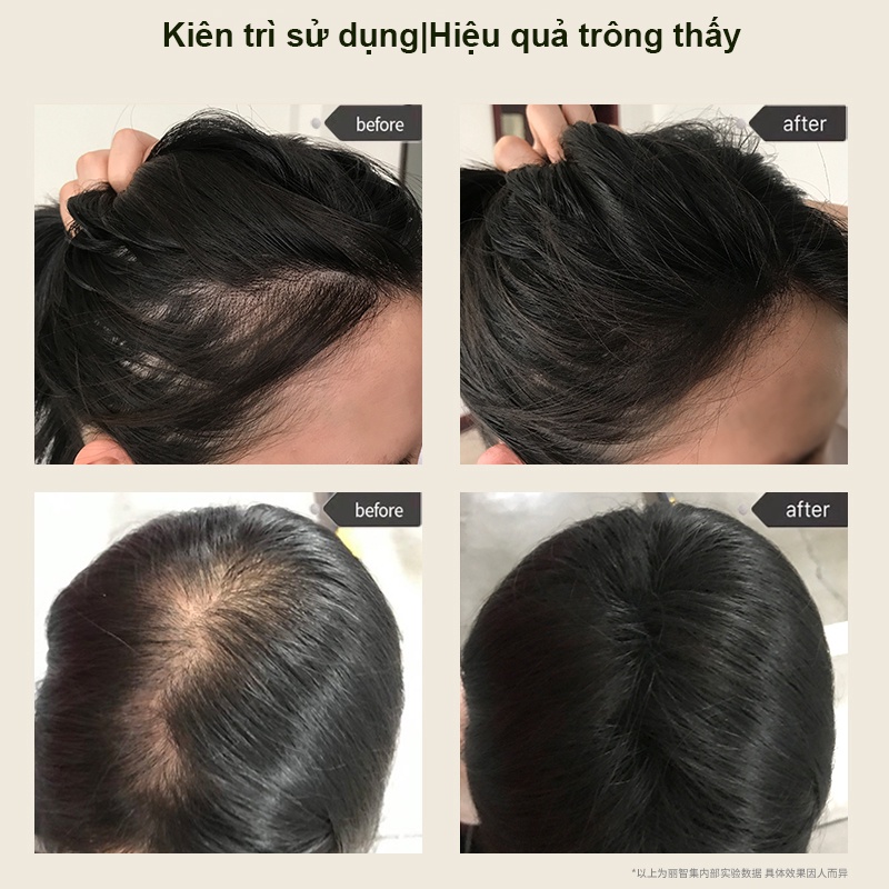 Xịt kích thích mọc tóc Ginger King chống rụng tóc tinh chất hà thủ ô Xịt  Tinh chất thảo dược chống rụng và làm đen tóc dưỡng tóc từ chân đến ngọn dầy tóc