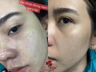 Serum collagen 100%