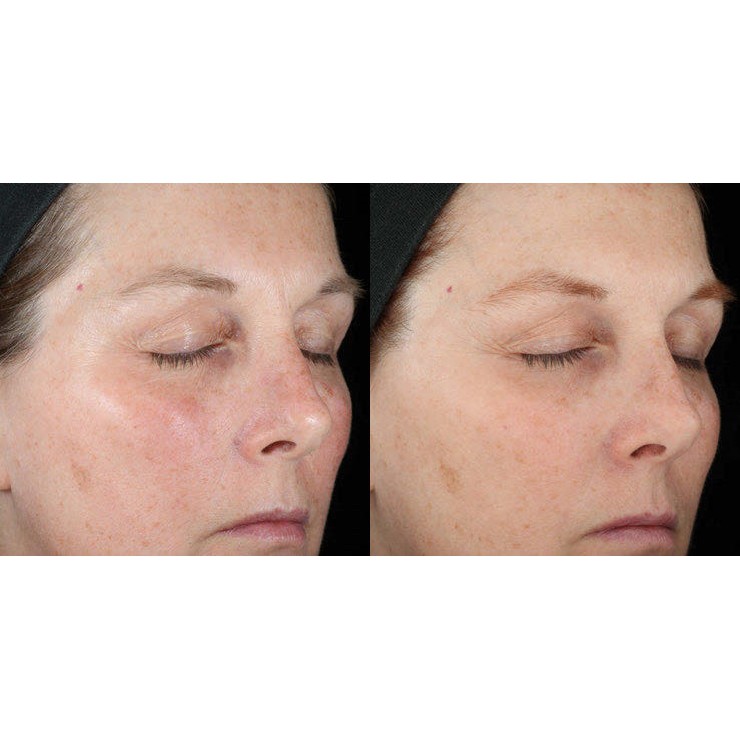 Serum dưỡng da Skinceuticals Metacell Renewal B3