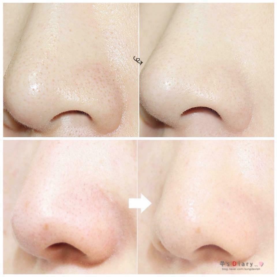 Thanh Lăn Mụn Đầu Đen Se Khít Lỗ Chân Lông Mamonde Pore Clean Blackhead Stick