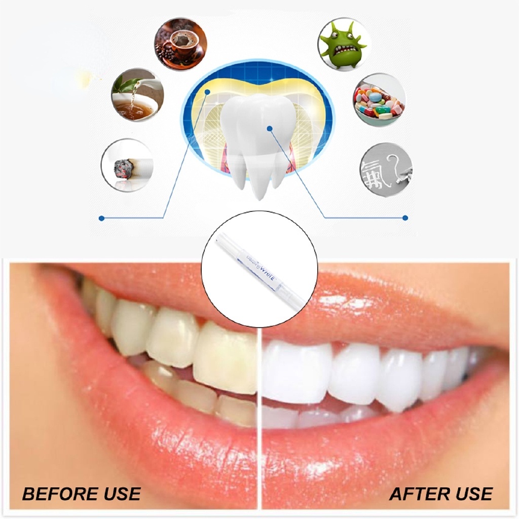 Bút làm trắng răng tức thì dạng xoay tiện dụng