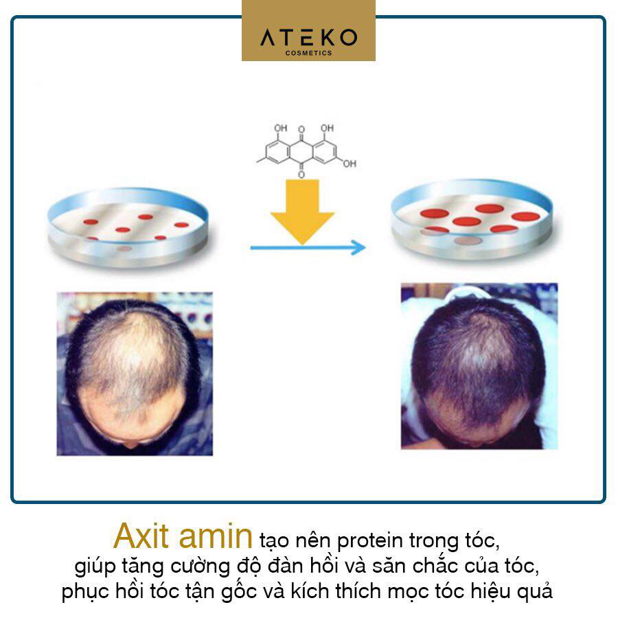 Bộ 3 Ưu Việt Eva Capilo Vitalikum - Chống Rụng Tóc Kinh Niên, Kích Mọc Tóc Hiệu Qủa Dành Cho Da Đầu Gàu Dầu