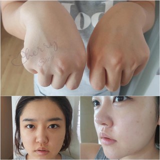 Kem truyền trắng Cindeltox