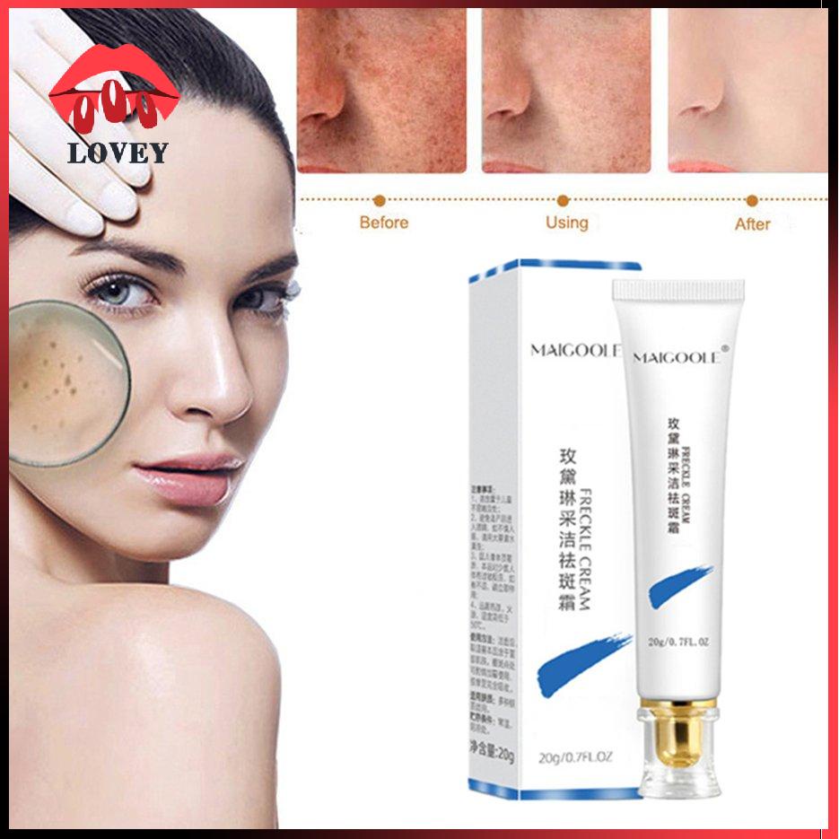 [Hàng mới về] Kem Giảm Tàn Nhang Dưỡng Ẩm Hiệu Quả | BigBuy360 - bigbuy360.vn