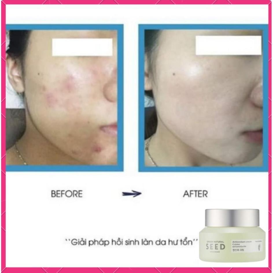 [KOREA] Kem Dưỡng Da Chống Lão Hoá Phục Hồi Da Mặt Chuyên Sâu Hàn Quốc Tái Tạo, Mờ Thâm Green Natural Seed The Face Shop | BigBuy360 - bigbuy360.vn