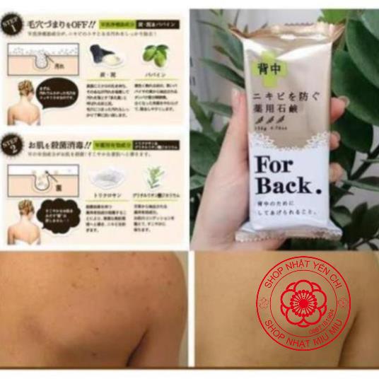 Xà phòng mụn lưng Forback (For back) Nhật Bản