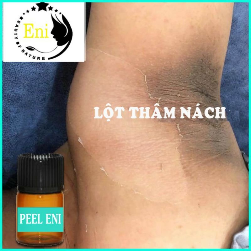 Peel Lột Nách Hết Thâm Sạm Trắng Da