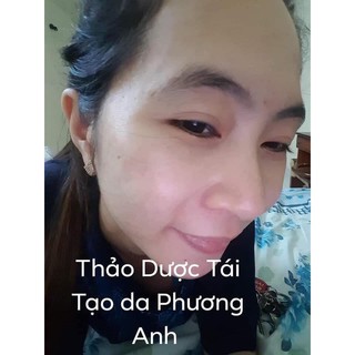 Combo tái tạo da Phương Anh