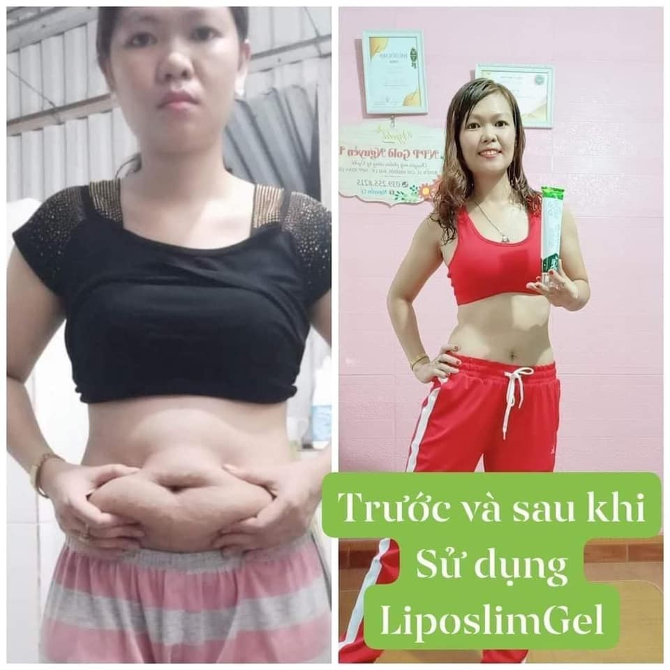 [DATE MỚI][CHÍNH HÃNG] - Kem tan mỡ LIPO SLIM GEL VYCHI 180gr, cho mẹ bầu sau sinh, giảm 3-5cm vòng bụng sau 1 Tuần