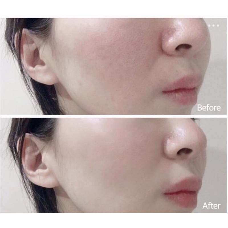 [ĐỦ BILL] KEM NỀN BLEMISH BALM (BB CREAM) CELL FUSION C 50ML | BigBuy360 - bigbuy360.vn