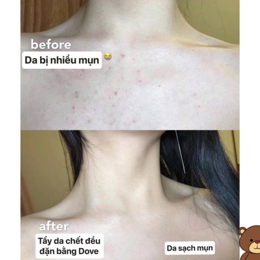 [HÀNG HOT] Tẩy da chết body DOVE giúp da mịn màng chiết xuất từ thiên nhiên hũ 50g | BigBuy360 - bigbuy360.vn