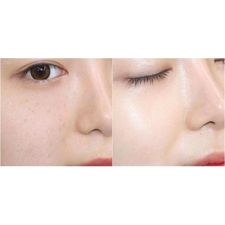 [Hóa đơn chính hãng] TINH CHẤT BALANCE VITAMIN C DƯỠNG SÁNG DA, MỜ VẾT THÂM