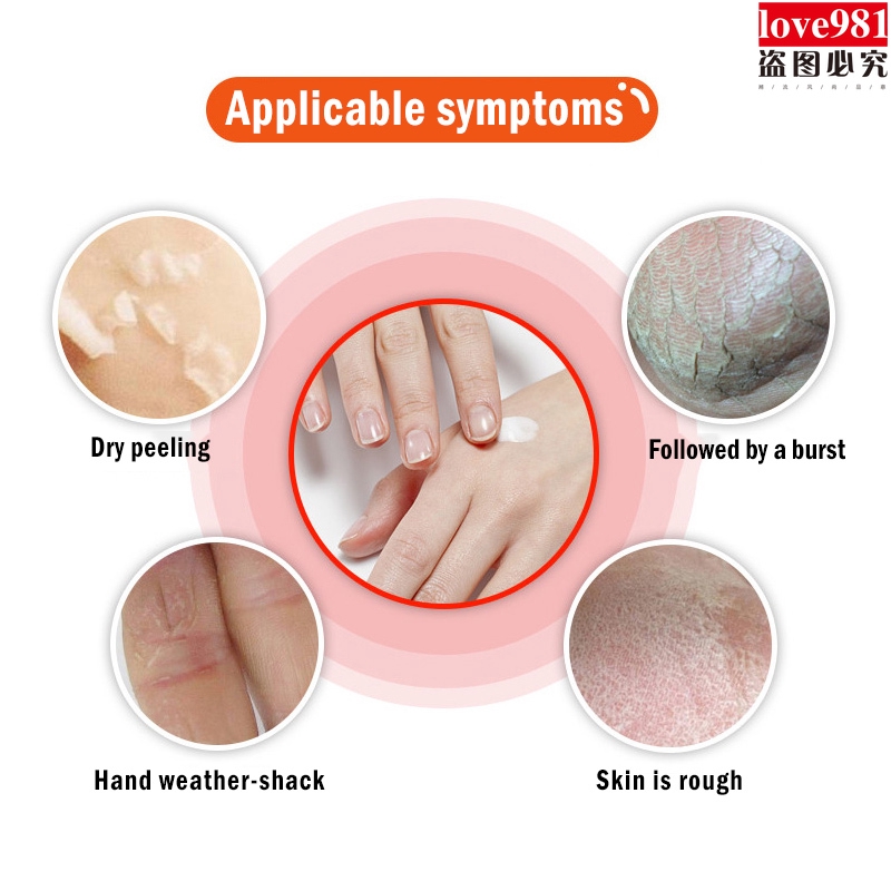 Kem dưỡng ẩm chống nứt nẻ tinh dầu chuối cao cấp | BigBuy360 - bigbuy360.vn