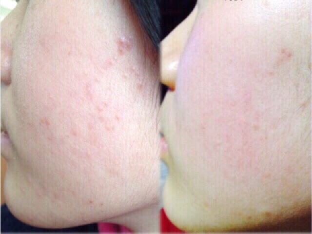 Sale 39% Xịt Khoáng Khóa lớp Nền Trang điểm Kiss Beauty | BigBuy360 - bigbuy360.vn